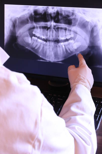 Best Emergency Broken Tooth Repair in Brent, AL