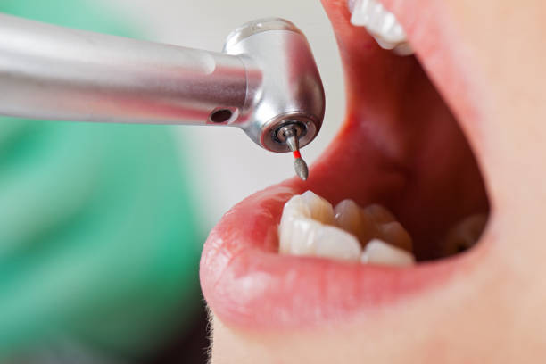 Best Pediatric Emergency Dentist in Brent, AL
